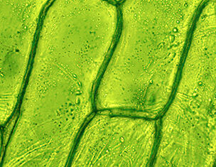 Close-up of green plant cells, showing cell walls and chloroplasts under a microscope.