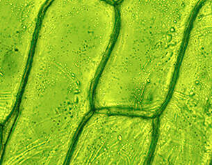 Close-up of green plant cells, showing cell walls and chloroplasts under a microscope.