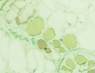 Vue microscopique de cellules vegetales avec des chloroplastes en vert, montrant des structures internes circulaires.