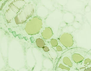 Vue microscopique de cellules vegetales avec des chloroplastes en vert, montrant des structures internes circulaires.