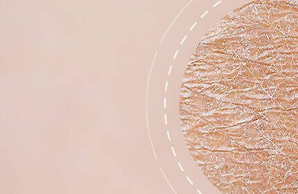 Close-up of textured skin, showing fine lines and a natural tone, with a blurred background.