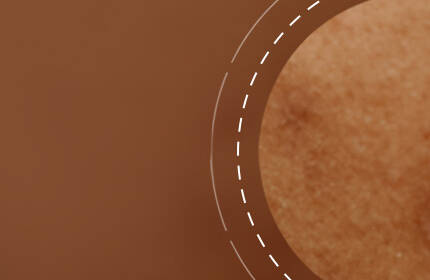 Close-up of textured skin in a warm brown tone, with a blurred background.