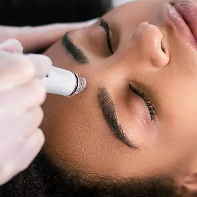 IPL Laser