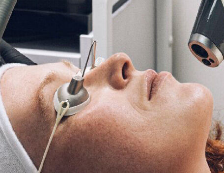 NICHT-ABLATIVER LASER​