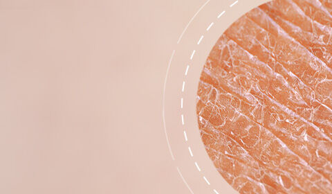 Close-up of textured skin with subtle variations in color, set against a soft, blurred background.