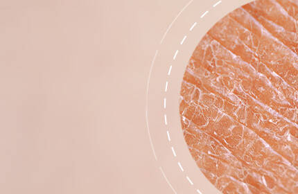 Close-up of textured skin with subtle variations in color, set against a soft, blurred background.