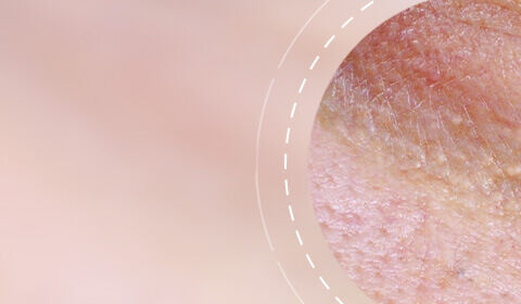 Close-up of textured skin with varying tones, set against a soft pink background.