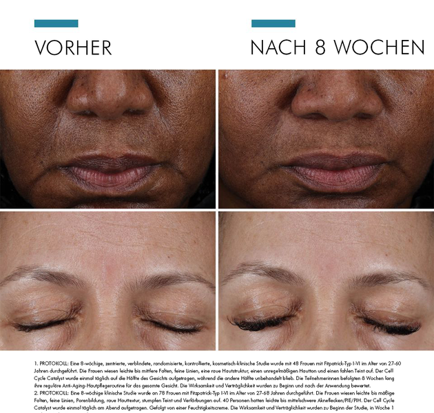 Vorher-Nachher-Vergleich der Haut einer Frau nach 8 Wochen Behandlung zur Verbesserung des Hautbildes.