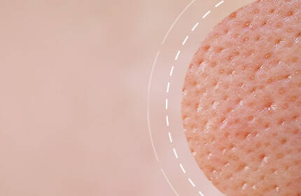 Close-up of textured skin with a soft, blurred background.