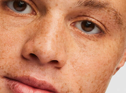 Un gros plan sur le visage d'une personne avec des taches de rousseur et des yeux marron, affichant une expression neutre.