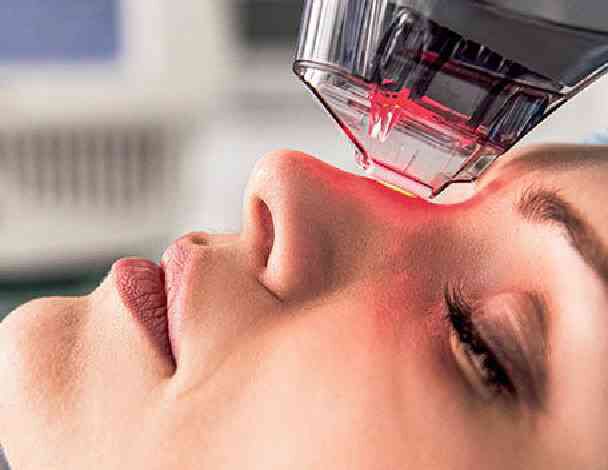 Une personne recoit un traitement au laser sur le visage, avec un rayon rouge projete sur la peau.