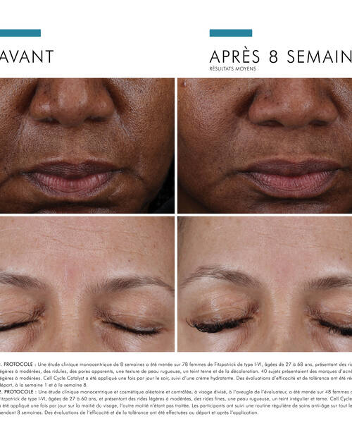 Avant et apres : resultat d'un traitement de soin de la peau sur le visage, montrant une amelioration notable apres 8 semaines.