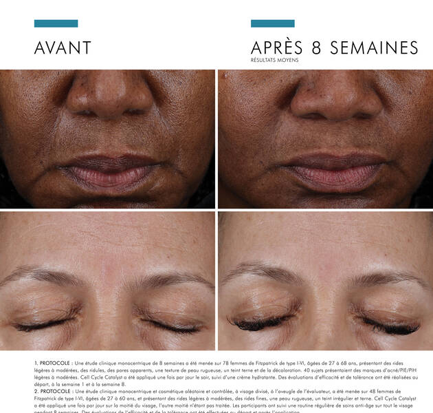 Avant et apres : resultat d'un traitement de soin de la peau sur le visage, montrant une amelioration notable apres 8 semaines.
