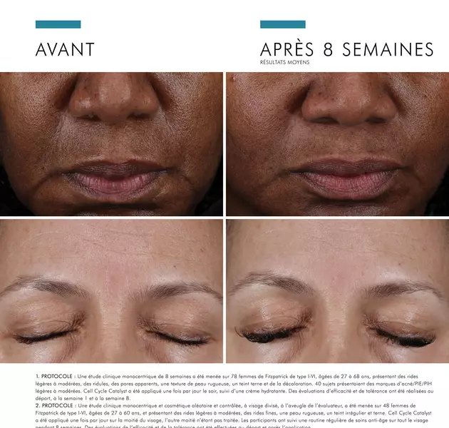 Avant et apres : resultat d'un traitement de soin de la peau sur le visage, montrant une amelioration notable apres 8 semaines.