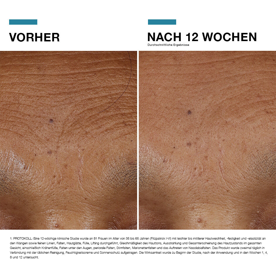 Hyaluronic Acid Intensifier Multi-Glycan