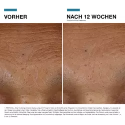 Hyaluronic Acid Intensifier Multi-Glycan