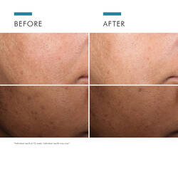 Discoloration Defense
