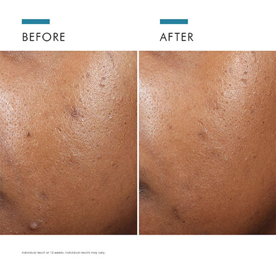 Phyto A+ Brightening Treatment