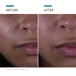 Silymarin CF