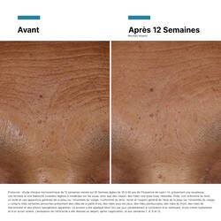 Hyaluronic Acid Intensifier Multi-Glycan